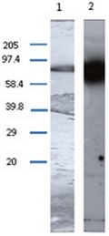 AP55334PU-N - Transglutaminase-1 (TGM1)