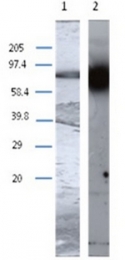 AP55343PU-N - Transglutaminase-1 (TGM1)