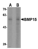 AP55411PU-N - BMP15 / GDF9B