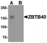 AP55412CP-N - ZBTB40