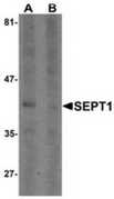 AP55413CP-N - Septin-1 (SEPT1)