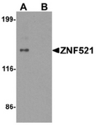 AP55421CP-N - ZNF521