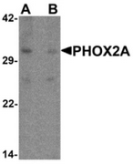 AP55428CP-N - PHOX2A