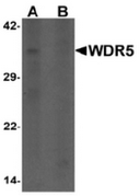 AP55430CP-N - WDR5 / BIG3