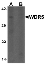 AP55430PU-N - WDR5 / BIG3