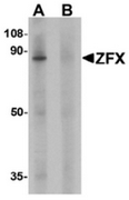AP55433CP-N - ZFX