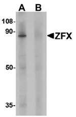 AP55433PU-N - ZFX