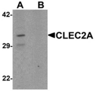 AP55437CP-N - CLEC2A