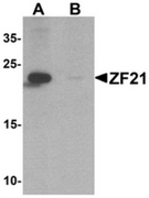 AP55438CP-N - ZFYVE21