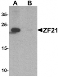 AP55438PU-N - ZFYVE21