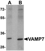AP55441PU-N - VAMP-7 / SYBL1