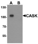 AP55443CP-N - CASK