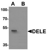 AP55444CP-N - KIAA0141
