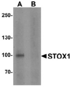 AP55447CP-N - STOX1
