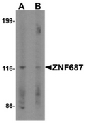 AP55449CP-N - ZNF687