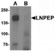 AP55467CP-N - LNPEP