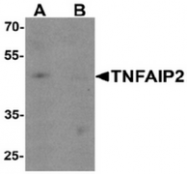 AP55469CP-N - TNFAIP2