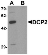 AP55470CP-N - DCP2
