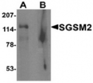 AP55475CP-N - SGSM2