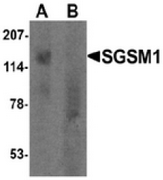 AP55476CP-N - SGSM1