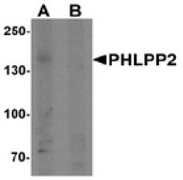 AP55482CP-N - PHLPP2