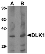 AP55484PU-N - DLK1