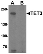 AP55486CP-N - MGC22014