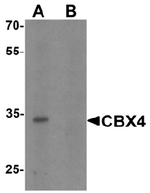 AP55488PU-N - CBX4 / PC2