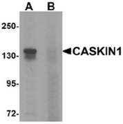 AP55493CP-N - CASKIN1