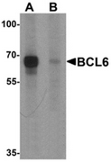 AP55495CP-N - Bcl-6