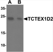 AP55503CP-N - TCTEX1D2