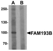 AP55508CP-N - FAM193B