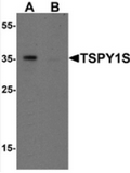 AP55516CP-N - TSPY1 / TSPY