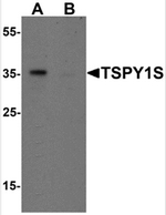AP55516PU-N - TSPY1 / TSPY