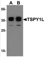 AP55517PU-N - TSPY1 / TSPY