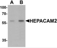 AP55520PU-N - HEPACAM2