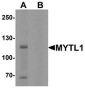 AP55531CP-N - MYT1L