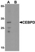 AP55534CP-N - CEBPD