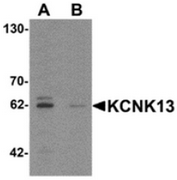 AP55537CP-N - KCNK13