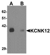 AP55538CP-N - KCNK12