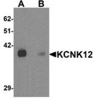AP55538PU-N - KCNK12