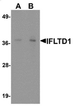 AP55542PU-N - IFLTD1
