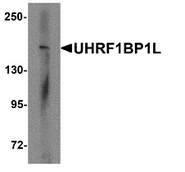 AP55547PU-N - UHRF1BP1L
