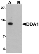 AP55552CP-N - DDA1