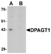 AP55553CP-N - DPAGT1