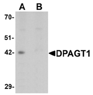 AP55553PU-N - DPAGT1