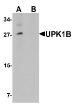 AP55558PU-N - Uroplakin-1b (UPK1B)
