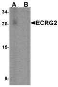 AP55561CP-N - ECRG-2