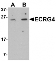 AP55562PU-N - Augurin