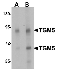 AP55563PU-N - Transglutaminase-5 (TGM5)